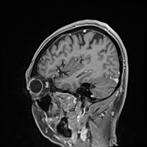 Click on the Serie image to view the images of VILLANUEVA, WILLIAM A.